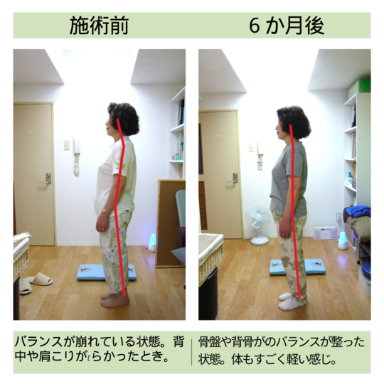 レア】村上式ほぐし実践テクニック基本編 カイロプラクティック／整体